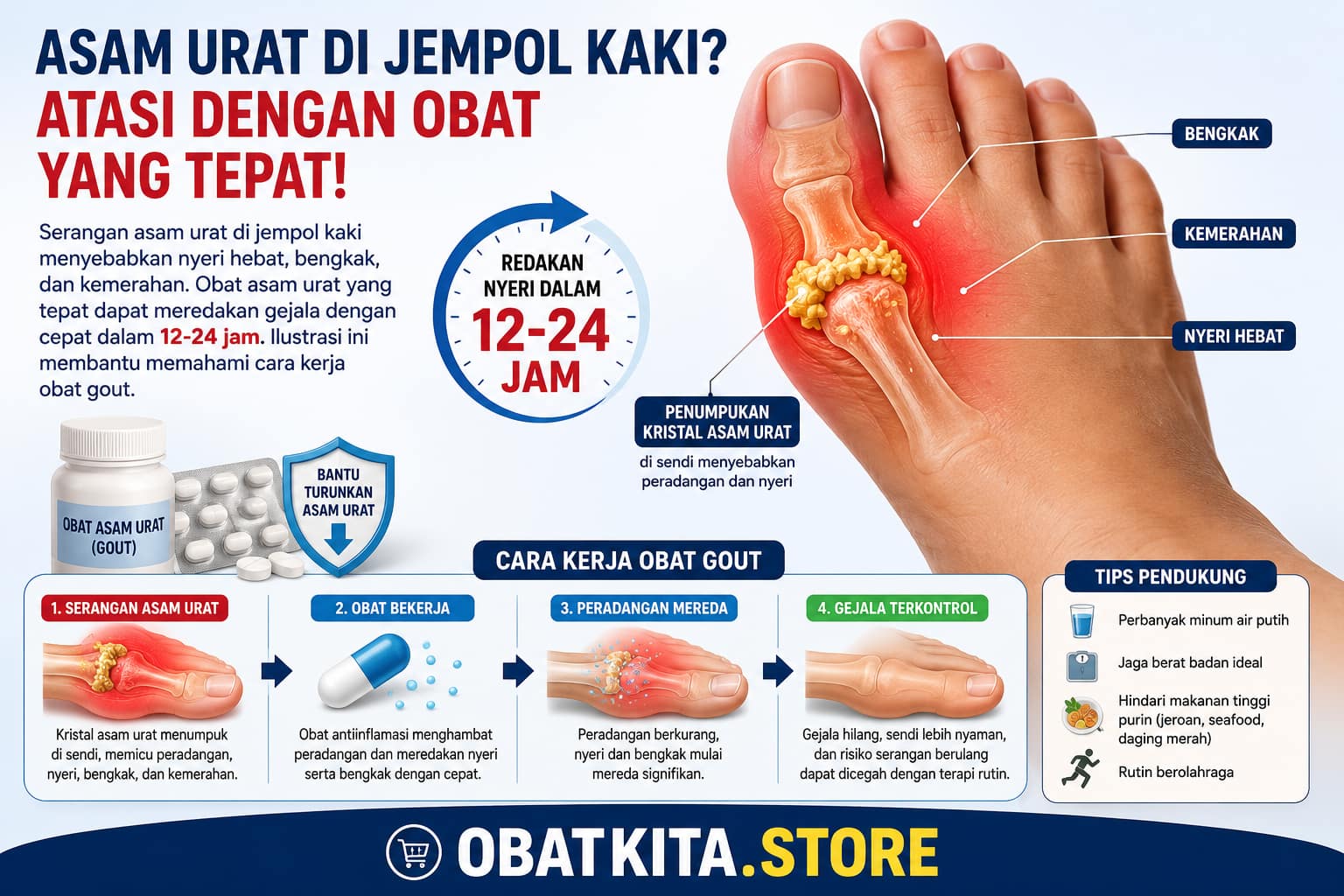 Serangan asam urat di jempol kaki menyebabkan nyeri hebat, bengkak, dan kemerahan. Obat asam urat yang tepat dapat meredakan gejala dengan cepat dalam 12-24 jam. Ilustrasi ini membantu memahami cara kerja obat gout.