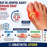 Serangan asam urat di jempol kaki menyebabkan nyeri hebat, bengkak, dan kemerahan. Obat asam urat yang tepat dapat meredakan gejala dengan cepat dalam 12-24 jam. Ilustrasi ini membantu memahami cara kerja obat gout.